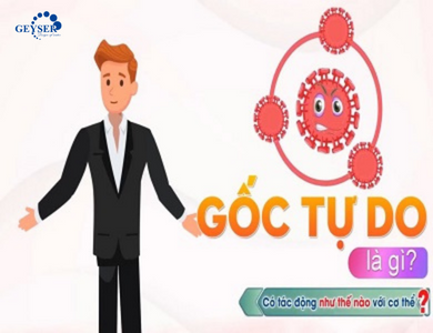 gốc tự do