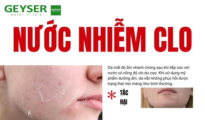 Nước nhiễm clo có thể khiến da trở nên khô ráp