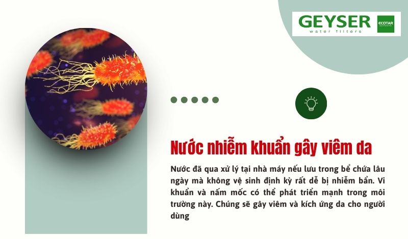 Nước nhiễm vi khuẩn có thể gây viêm da khi tiếp xúc