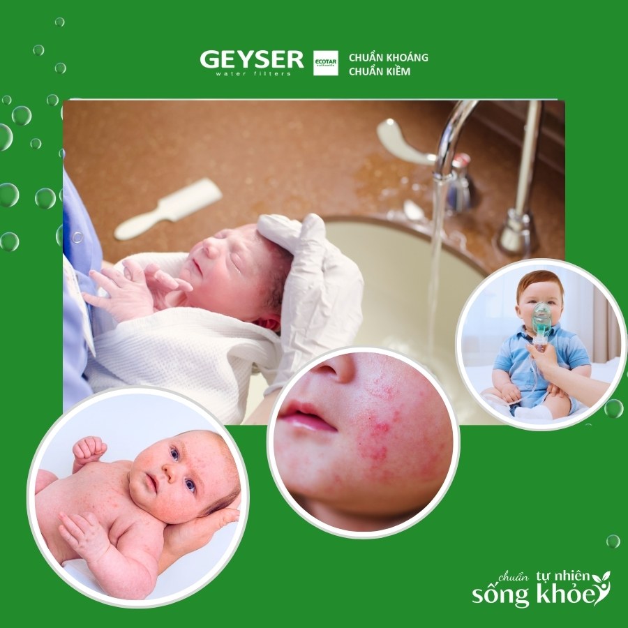 Những vấn đề về da và sức khỏe hô hấp khi tắm bé bằng nước máy có clo dư